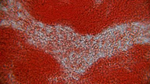 Human blood under a microscope. You can see erythrocytes - red blood cells... Stock Photos