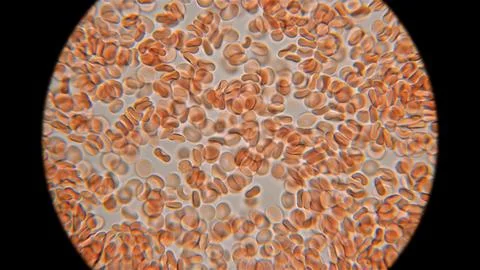 Human blood under a microscope. You can see erythrocytes - red blood cells... Stock Photos