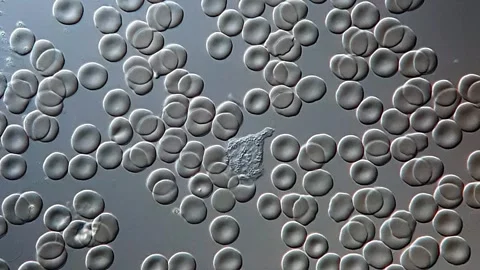 Human Blood under microscopy, DIC microscope contrast 库存影片 306592033