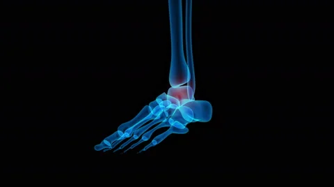Human Body Bone Joints Pain Anatomy 库存影片 65783348