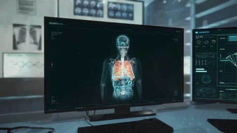 Human Body Image On Computer Screen Is Analyzed To Find Mutations In Virus Stock Footage 273330881