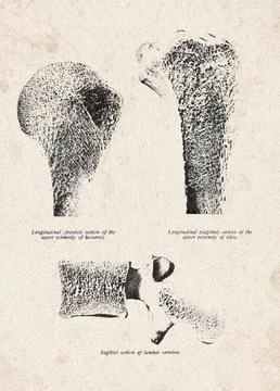 Human Bone Sections Humerus Tibia And Lumbar Vertebra Vintage Anatomy Illus.. Stock Illustration
