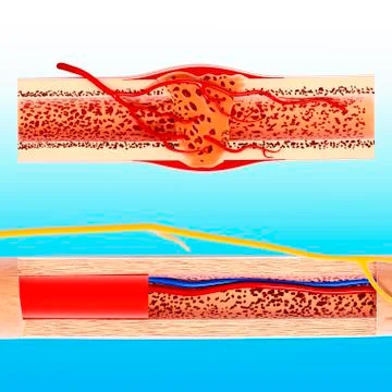 Human bone structure, artwork Stock Illustration
