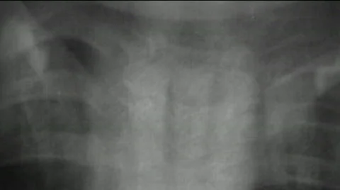 Human bones background - digital animation Stock Footage 467574