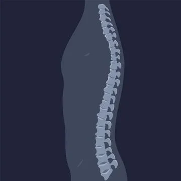 Human bones orthopedic and skeleton icon, bone x-ray image of human joints Stock Illustration