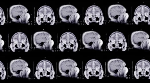 Human brain. Animated background Stock Footage 35437442