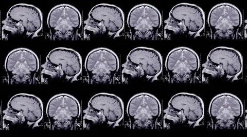 Human brain. Animated background Stock Footage 35438031