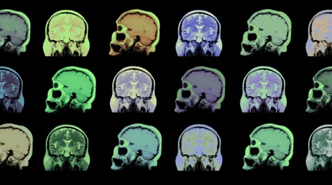 Human brain. Animated background 스톡 동영상 35790516