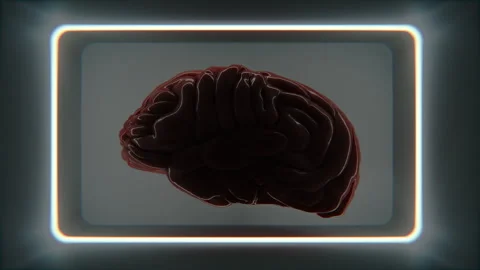 Human Brain Being Scanned Stock Footage 285525458
