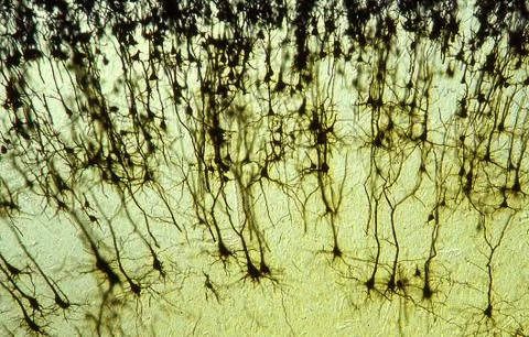 Human brain cells silvering under the microscope 100x Stock Photos