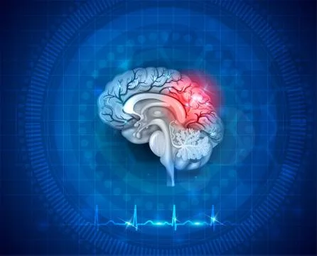 Human brain damage and treatment Stock Illustration