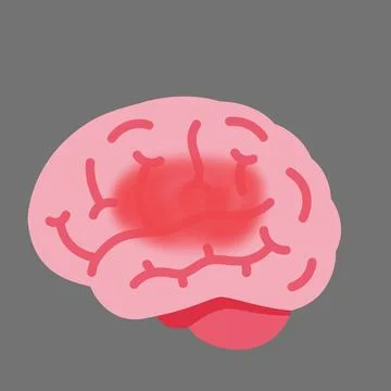 Human brain with disease redness inflammation concept Stock Illustration
