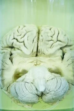 Human brain in formalin solution closeup Stock Photos