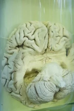 Human brain in formalin solution closeup Stock Photos