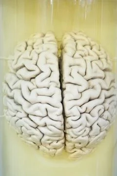 Human brain in formalin solution closeup Stock Photos