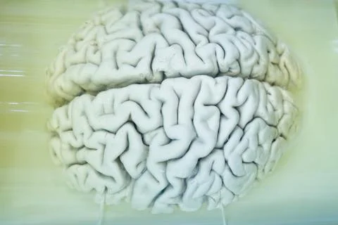Human brain in formalin solution closeup Stock Photos