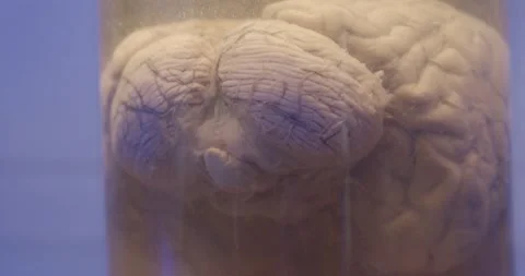 Human brain in a glass jar, dissected 1 Stock Footage 219628229