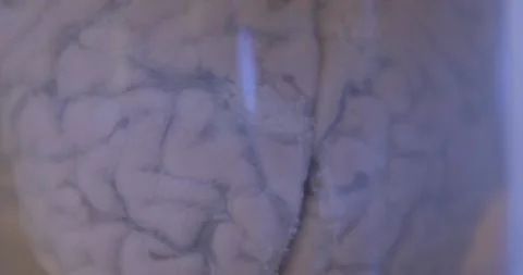 Human brain in a glass jar, dissected 2 Stock Footage 219630505