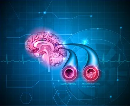 Human brain healt care Stock Illustration