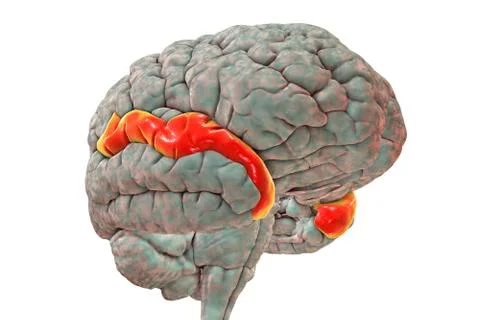 Human brain with highlighted superior temporal gyrus Stock Illustration