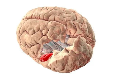 Human brain with highlighted transverse temporal gyri Illustrazione stock