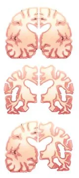 Human Brain イラスト素材