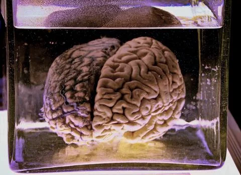 Human brain in the jar Stock Photos