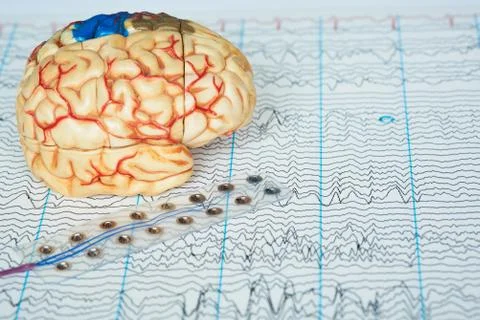 Human brain model and electrode recording brain waves on background of brain Stock Photos
