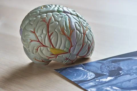 Human brain model and imageing of brain MRI Stock Photos