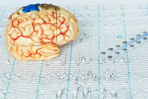 Human brain model and subdural electrode recording brain waves on background Stock Photos