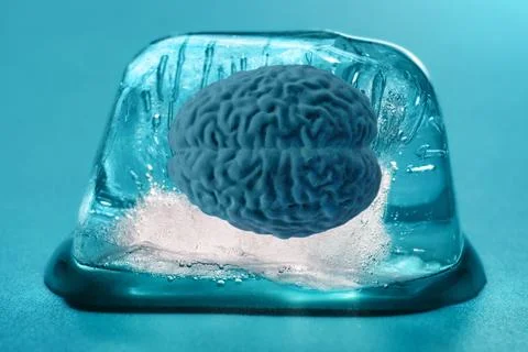 Human Brain Model Preserved in Cryogenic State Stock-Fotos