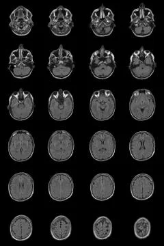 Human brain mri Stock Photos