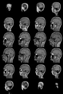 Human brain mri Stock Photos