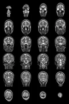 Human brain mri Stock Photos