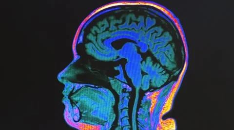 Human brain MRI scan Stock Footage