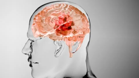 Human brain nervous system anatomy, neural cancer, Sebaceous bulb, malignant Stock Footage 287849484