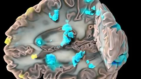 Human brain with neuronal impulses. Spinning. Loopable Stock Illustration