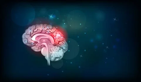 Human brain problems Stock Illustration