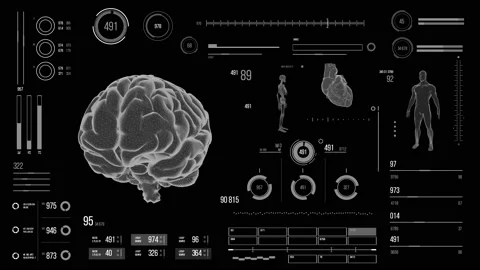 Human brain scan. Stock Footage 118877498