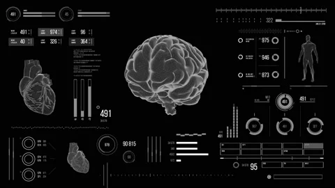 Human brain scan. Stock Footage 118877644