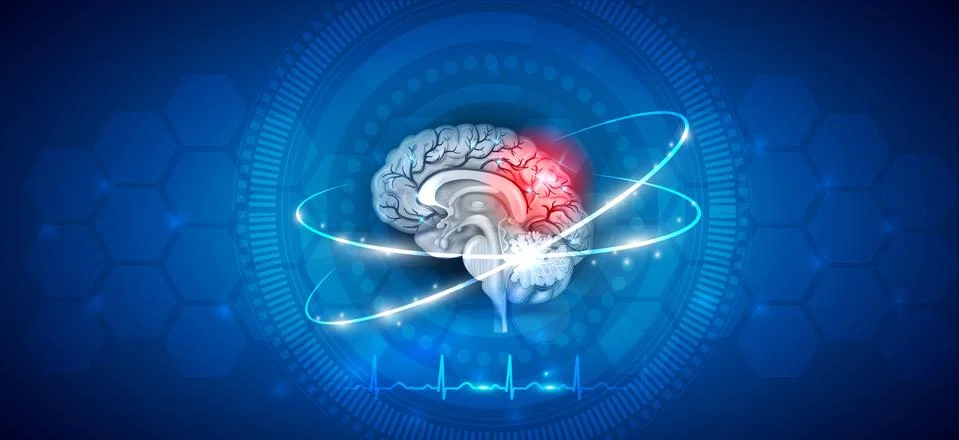 Human brain treatment Stock Illustration