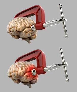 Human brain in a vice Stock Illustration