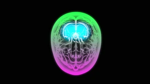 Human Brain X-Ray View from Top focusing power Stock-Footage 168613158