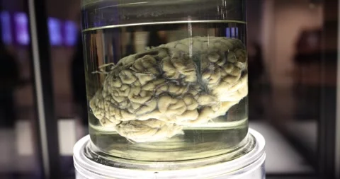 Human brains in formaldehyde jar lab Video stock 255811674