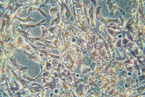 Human cancer cells at microscope Photos