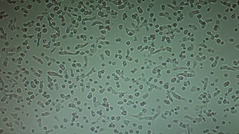 Human cell culture. Timelapse microscope, Stock Footage 108077485