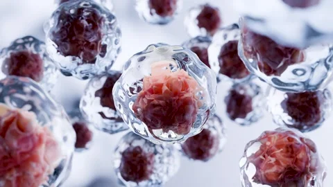 Human cells death, Embryonic stem cell, metastasis Growing tumor, Leukemia Stock Footage 284211438