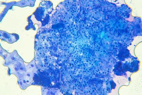 Human cells at microscope 스톡 사진