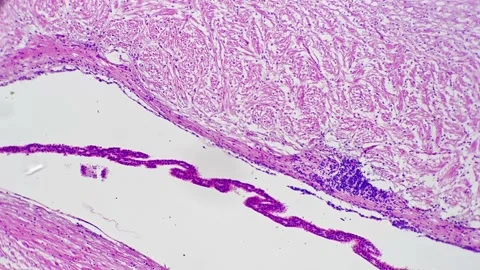 Human cerebrum in section with high magnification 100x shown under microscope on Stock Footage 226835637