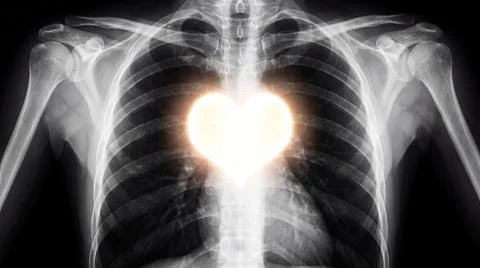 Human chest x-ray with glowing heart highlighting cardiac health. Stock Illustration
